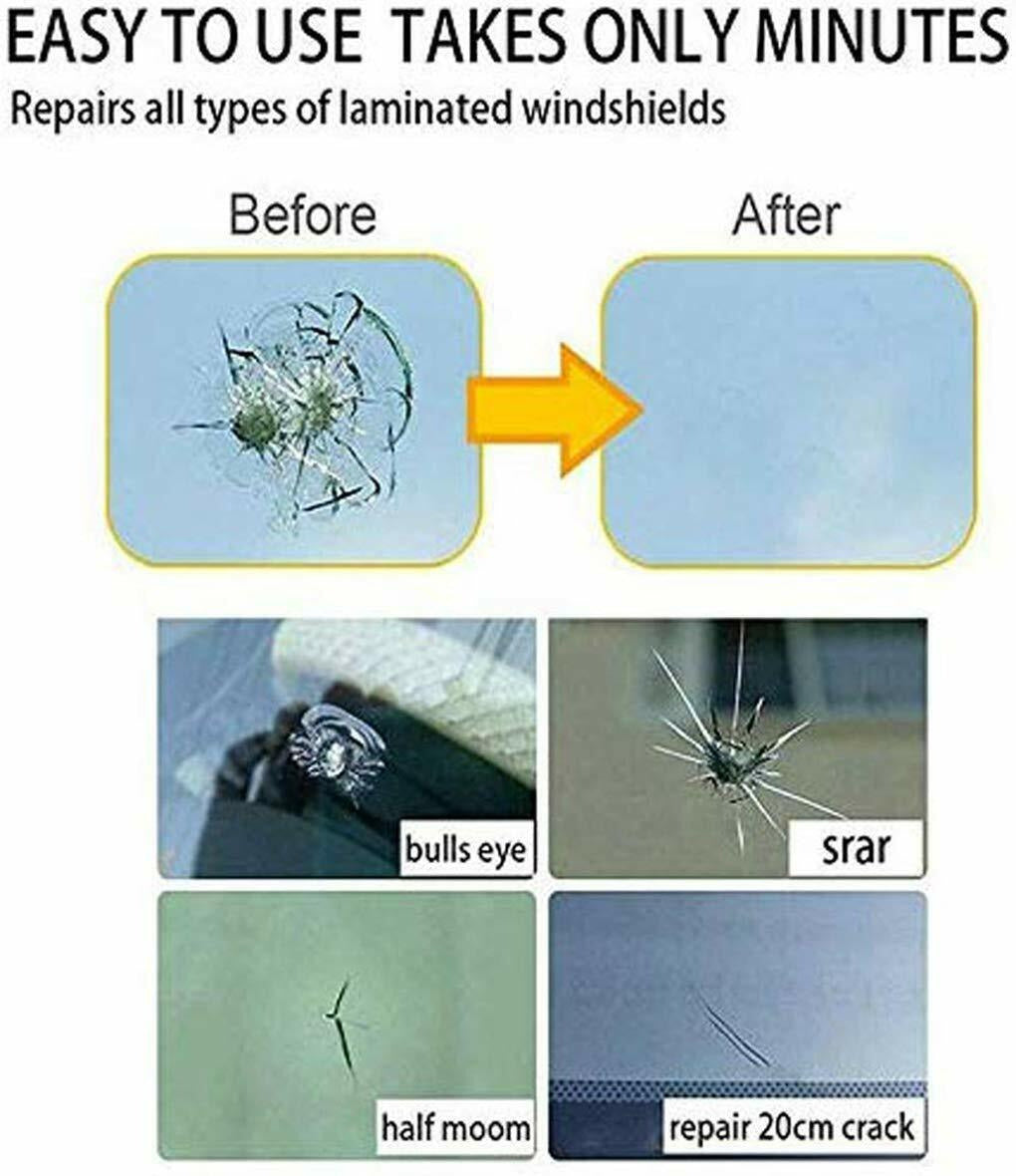 Windshield Repair Kit for Car Glass Chips, Cracks, and Resin Fix